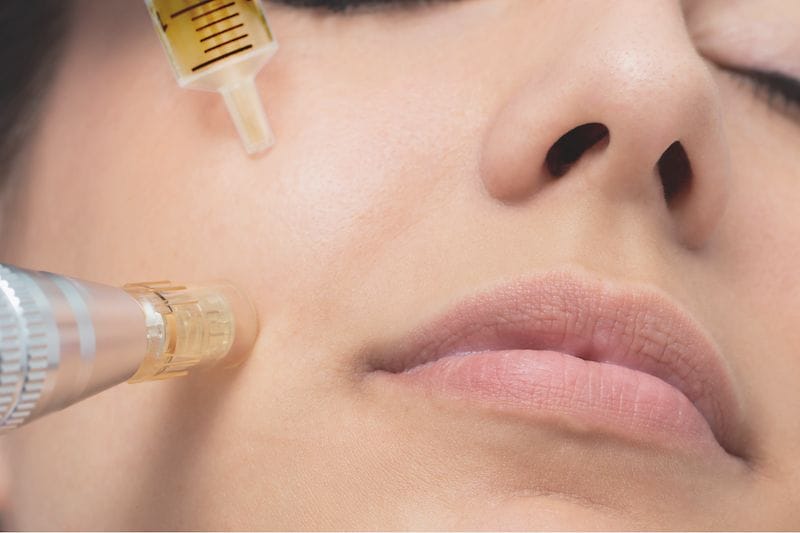 Facial Aesthetics
